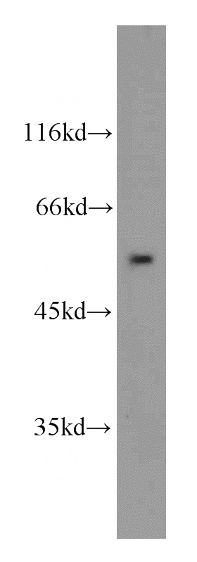 HepG2 cells were subjected to SDS PAGE followed by western blot with Catalog No:113981(PNPLA3 antibody) at dilution of 1:100