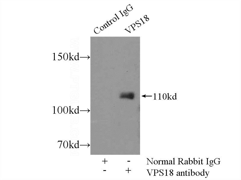 IP Result of anti-VPS18 (IP:Catalog No:116774, 4ug; Detection:Catalog No:116774 1:300) with HeLa cells lysate 920ug.