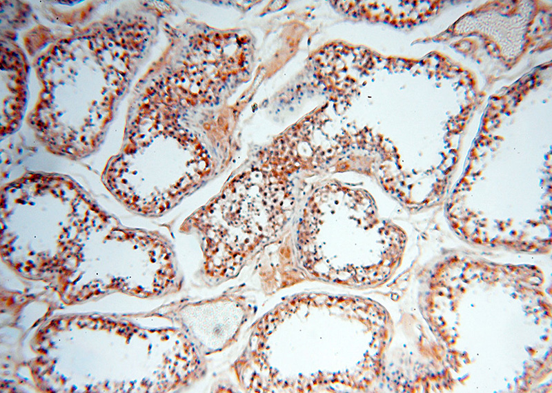 Immunohistochemical of paraffin-embedded human testis using Catalog No:112135(KRT80 antibody) at dilution of 1:200 (under 10x lens)