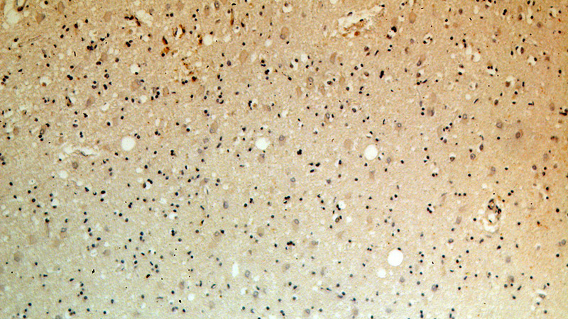 Immunohistochemical of paraffin-embedded human brain using Catalog No:112074(KLC2 antibody) at dilution of 1:100 (under 10x lens)