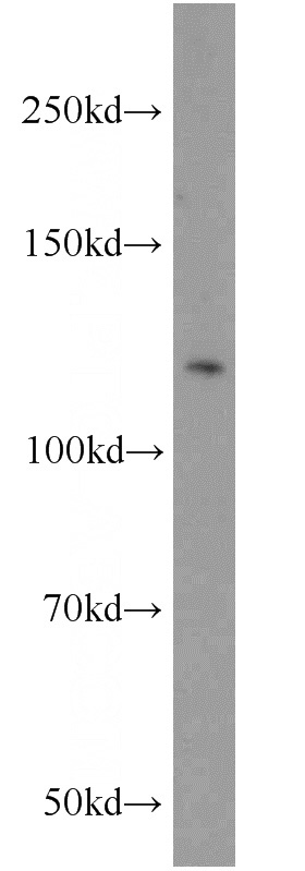 mouse brain tissue were subjected to SDS PAGE followed by western blot with Catalog No:113038(NAP1;NCKAP1 antibody) at dilution of 1:1000