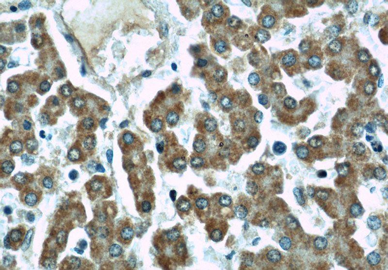 Immunohistochemical of paraffin-embedded human liver using Catalog No:116126(TIMM22 antibody) at dilution of 1:50 (under 40x lens)