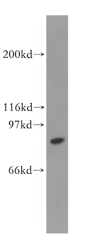 Jurkat cells were subjected to SDS PAGE followed by western blot with Catalog No:115689(STAT4 antibody) at dilution of 1:300