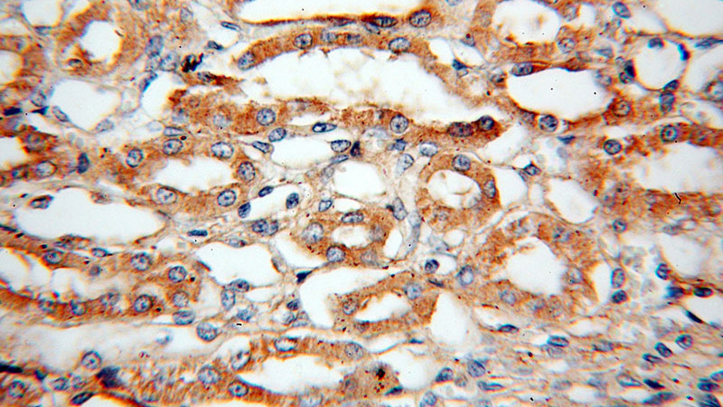 Immunohistochemical of paraffin-embedded human kidney using Catalog No:117143(SH3GLB1 antibody) at dilution of 1:100 (under 40x lens)