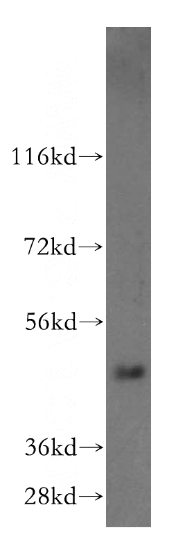 human liver tissue were subjected to SDS PAGE followed by western blot with Catalog No:115426(SMAP2 antibody) at dilution of 1:500