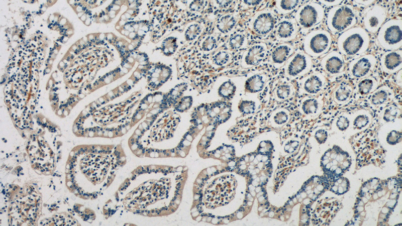 Immunohistochemistry of paraffin-embedded human small intestine tissue slide using Catalog No:116077(TLR7 Antibody) at dilution of 1:50 (under 10x lens)