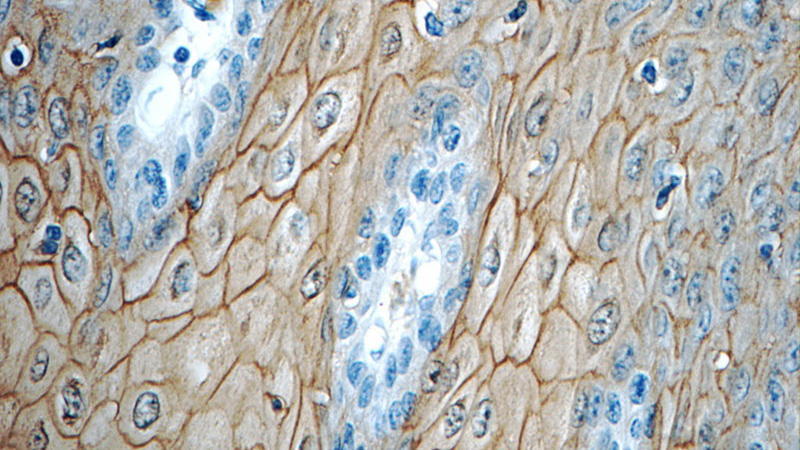 Immunohistochemistry of paraffin-embedded human oesophagus tissue slide using Catalog No:108088(ANXA1 Antibody) at dilution of 1:50 (under 40x lens)