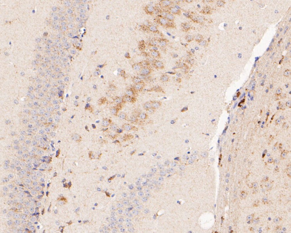 Fig2:; Immunohistochemical analysis of paraffin-embedded mouse brain tissue using anti-P2RX5 antibody. The section was pre-treated using heat mediated antigen retrieval with Tris-EDTA buffer (pH 8.0-8.4) for 20 minutes.The tissues were blocked in 5% BSA for 30 minutes at room temperature, washed with ddH; 2; O and PBS, and then probed with the primary antibody ( 1/200) for 30 minutes at room temperature. The detection was performed using an HRP conjugated compact polymer system. DAB was used as the chromogen. Tissues were counterstained with hematoxylin and mounted with DPX.
