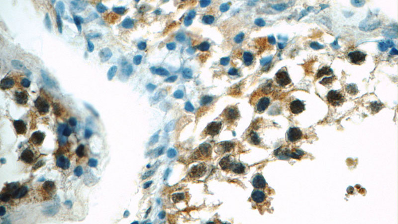 Immunohistochemistry of paraffin-embedded human testis tissue slide using Catalog No:116998(ZNF497 Antibody) at dilution of 1:50 (under 40x lens)