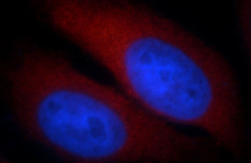 Immunofluorescent analysis of HepG2 cells, using POMP antibody Catalog No:114057 at 1:25 dilution and Rhodamine-labeled goat anti-rabbit IgG (red). Blue pseudocolor = DAPI (fluorescent DNA dye).