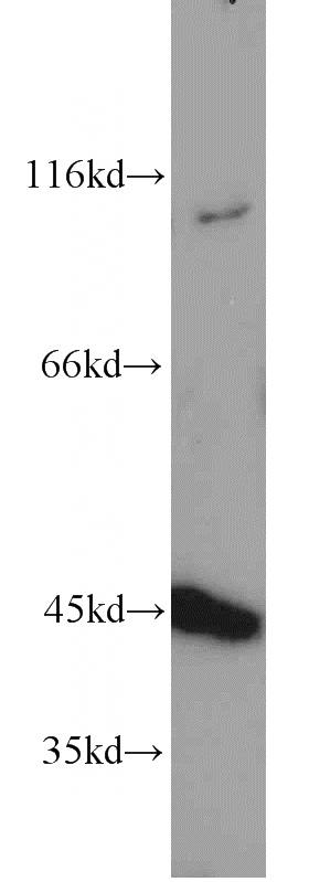 RAW264.7 cells were subjected to SDS PAGE followed by western blot with Catalog No:116286(TNFAIP3 antibody) at dilution of 1:1000