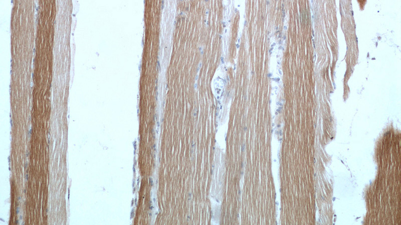 Immunohistochemical of paraffin-embedded human skeletal muscle using Catalog No:116151(TNNI1 antibody) at dilution of 1:50 (under 10x lens)