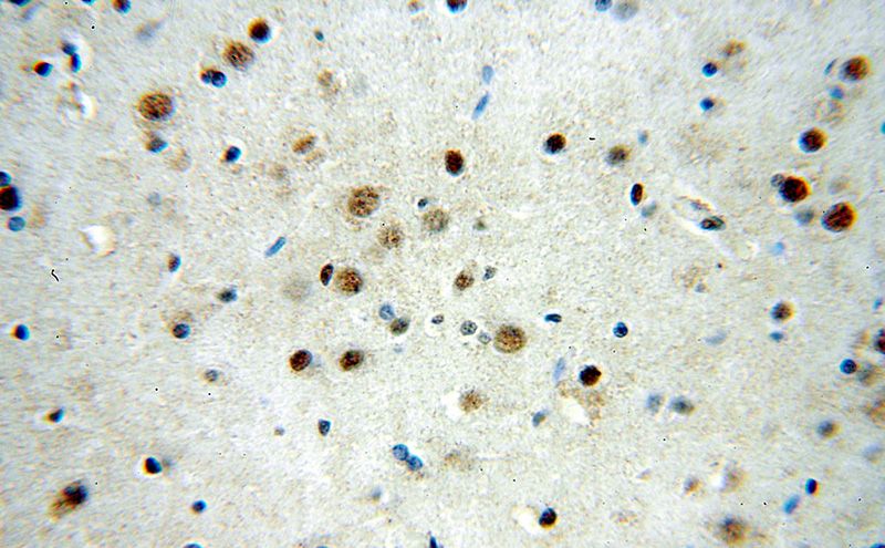 Immunohistochemical of paraffin-embedded human brain using Catalog No:115583(SRF antibody) at dilution of 1:50 (under 40x lens)