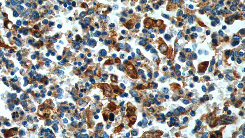 Immunohistochemistry of paraffin-embedded human spleen tissue slide using Catalog No:110626(FFAR2 Antibody) at dilution of 1:100 (under 40x lens).