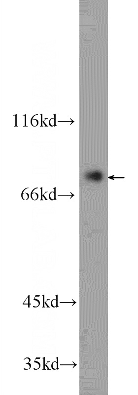HEK-293 cells were subjected to SDS PAGE followed by western blot with Catalog No:116919(ZBTB48 Antibody) at dilution of 1:600
