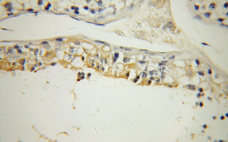 Immunohistochemical of paraffin-embedded human testis using Catalog No:116659(UBQLN3 antibody) at dilution of 1:100 (under 40x lens)