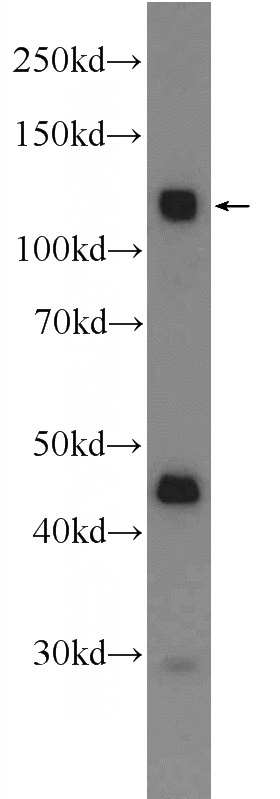 A549 cells were subjected to SDS PAGE followed by western blot with Catalog No:109151(CDCP1 Antibody) at dilution of 1:600