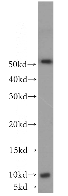 mouse skin tissue were subjected to SDS PAGE followed by western blot with Catalog No:110903(GCHFR antibody) at dilution of 1:500