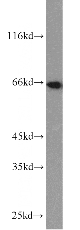 A375 cells were subjected to SDS PAGE followed by western blot with Catalog No:115809(STXBP1 antibody) at dilution of 1:1000