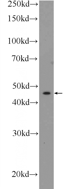 A431 cells were subjected to SDS PAGE followed by western blot with Catalog No:109454(GJA3 Antibody) at dilution of 1:600