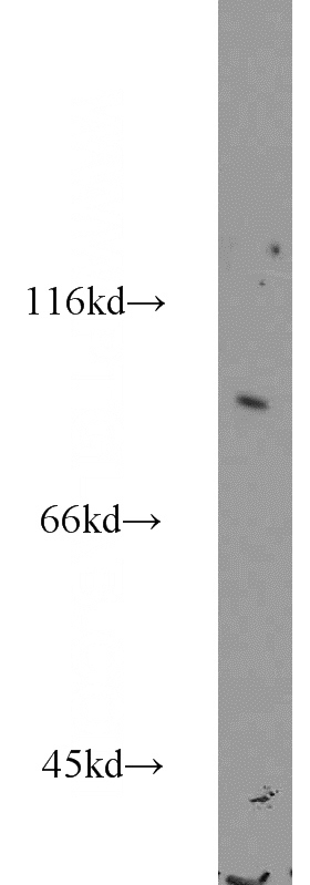 mouse testis tissue were subjected to SDS PAGE followed by western blot with Catalog No:108149(ARMC3 antibody) at dilution of 1:800