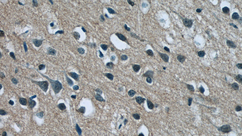 Immunohistochemistry of paraffin-embedded human brain tissue slide using Catalog No:108647(C12orf54 Antibody) at dilution of 1:50 (under 40x lens)