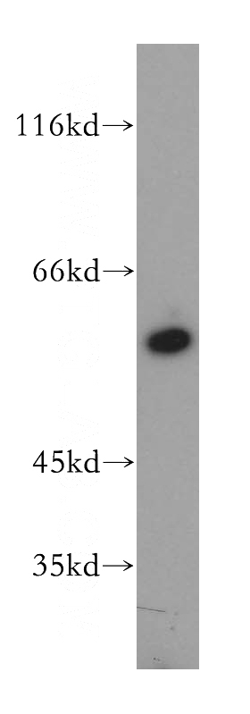 HEK-293 cells were subjected to SDS PAGE followed by western blot with Catalog No:110009(DPYS antibody) at dilution of 1:500