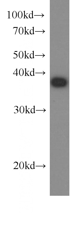 HeLa cells were subjected to SDS PAGE followed by western blot with Catalog No:107258(HDGF antibody) at dilution of 1:1000