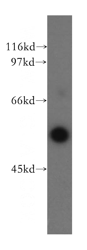 PC-3 cells were subjected to SDS PAGE followed by western blot with Catalog No:110242(EML2 antibody) at dilution of 1:400