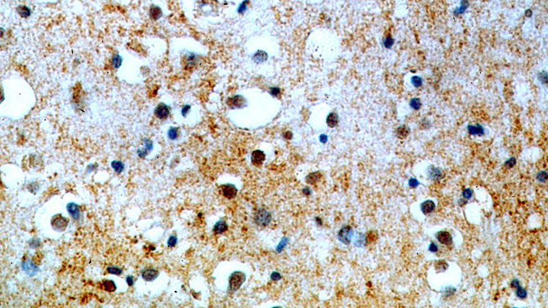 Immunohistochemical of paraffin-embedded human brain using Catalog No:116375(TTBK2 antibody) at dilution of 1:100 (under 40x lens)