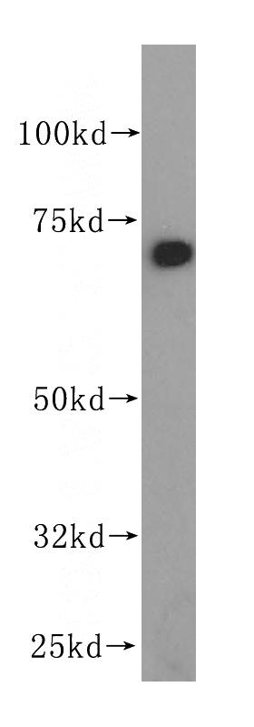 HepG2 cells were subjected to SDS PAGE followed by western blot with Catalog No:110375(PDIA4 antibody) at dilution of 1:500