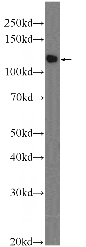 HeLa cells were subjected to SDS PAGE followed by western blot with Catalog No:116424(TSC22D2 Antibody) at dilution of 1:600