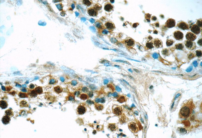 Immunohistochemistry of paraffin-embedded human testis tissue slide using Catalog No:108068(ANKRD13C Antibody) at dilution of 1:50 (under 40x lens)
