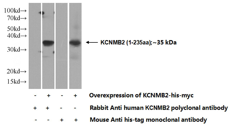 Transfected HEK-293 cells were subjected to SDS PAGE followed by western blot with Catalog No:111974(KCNMB2 Antibody) at dilution of 1:500