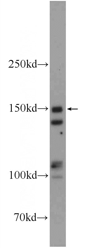 mouse brain tissue were subjected to SDS PAGE followed by western blot with Catalog No:114446(RAB3GAP2 Antibody) at dilution of 1:600