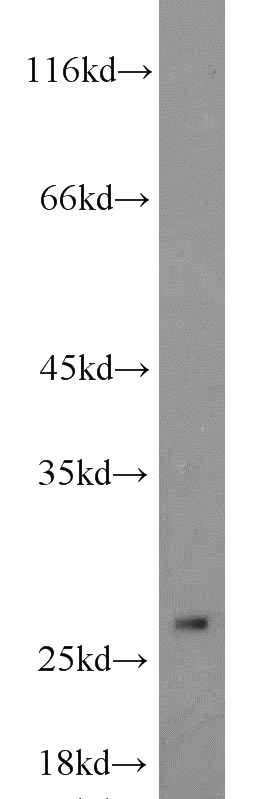 HeLa cells were subjected to SDS PAGE followed by western blot with Catalog No:110265(EIF4H antibody) at dilution of 1:800
