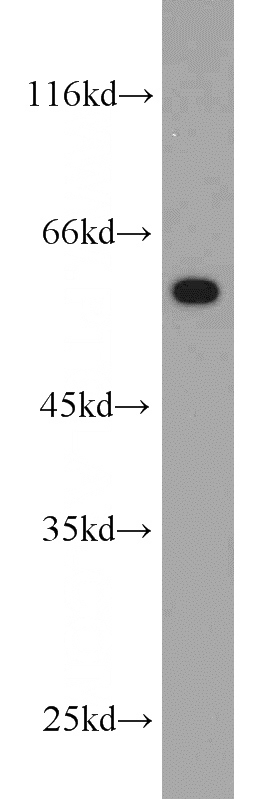 HeLa cells were subjected to SDS PAGE followed by western blot with Catalog No:109084(CCT5 antibody) at dilution of 1:1000
