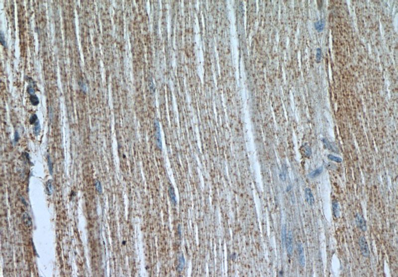 Immunohistochemistry of paraffin-embedded human skeletal muscle slide using Catalog No:108760(CACNA1S Antibody) at dilution of 1:50 (under 40x lens)