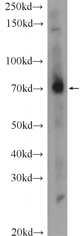 mouse liver tissue were subjected to SDS PAGE followed by western blot with Catalog No:112798(MPZL3 Antibody) at dilution of 1:1000