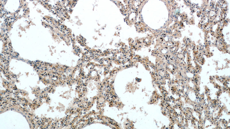 Immunohistochemical of paraffin-embedded human lung using Catalog No:117198(BMP4 antibody) at dilution of 1:50 (under 10x lens)