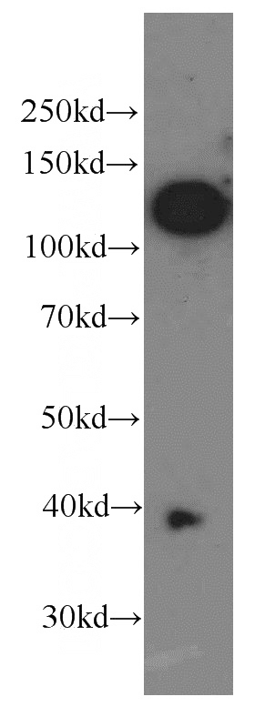 A375 cells were subjected to SDS PAGE followed by western blot with Catalog No:107045(CD146, MCAM antibody) at dilution of 1:1000