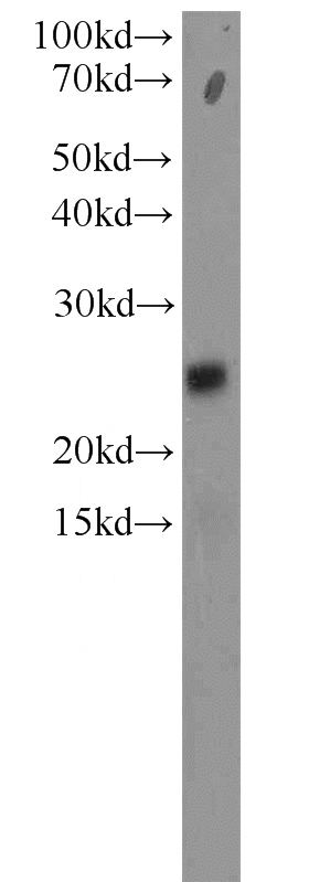 HeLa cells were subjected to SDS PAGE followed by western blot with Catalog No:114822(RPP25 antibody) at dilution of 1:300