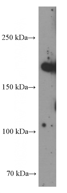 HeLa cells were subjected to SDS PAGE followed by western blot with (CLTCL1 Antibody) at dilution of 1:1000