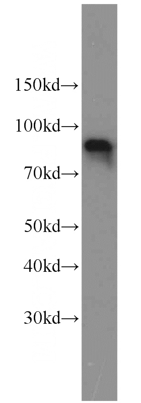 human brain tissue were subjected to SDS PAGE followed by western blot with Catalog No:113344(OPHN1 antibody) at dilution of 1:800