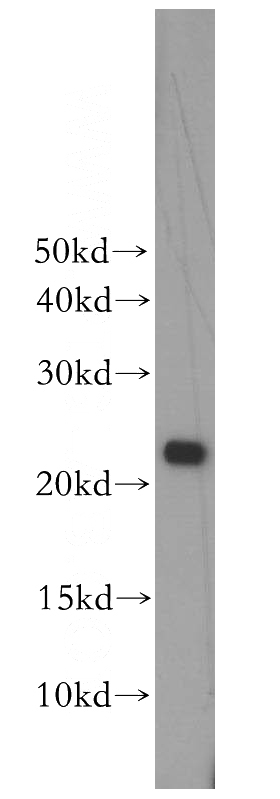 HepG2 cells were subjected to SDS PAGE followed by western blot with Catalog No:117191(BLVRB antibody) at dilution of 1:500