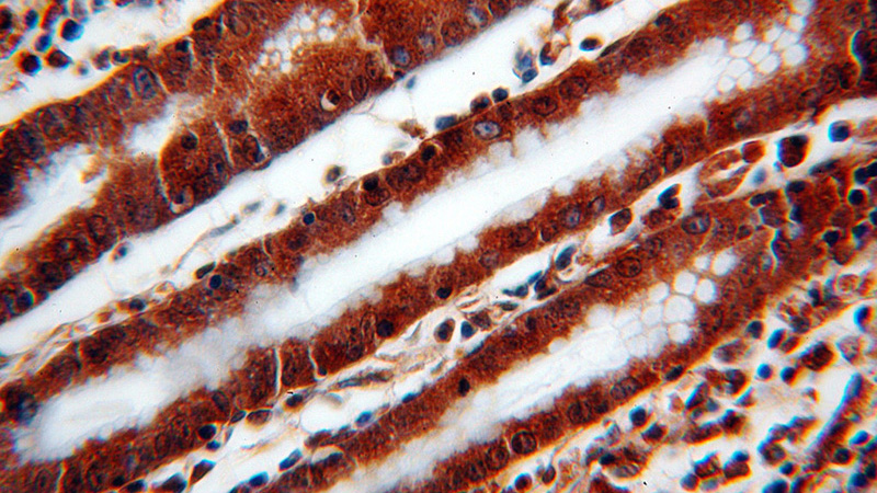 Immunohistochemical of paraffin-embedded human stomach using Catalog No:116612(UNC45A antibody) at dilution of 1:100 (under 40x lens)
