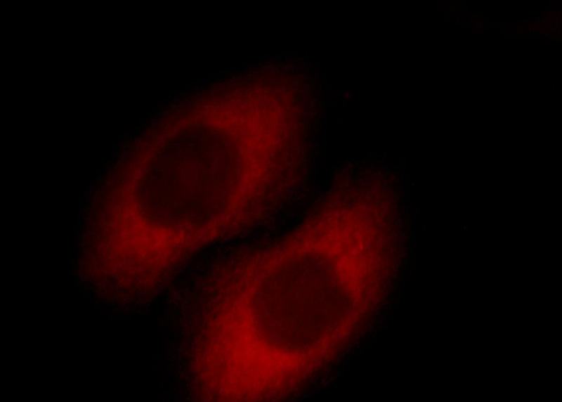Immunofluorescent analysis of HepG2 cells, using SCIN antibody Catalog No:114997 at 1:25 dilution and Rhodamine-labeled goat anti-rabbit IgG (red).