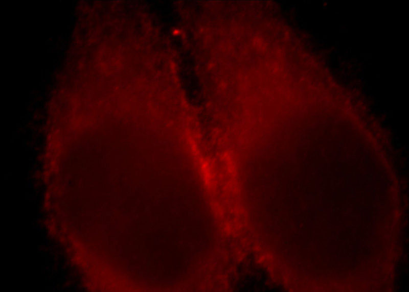 Immunofluorescent analysis of Hela cells, using LDHC antibody Catalog No:112186 at 1:25 dilution and Rhodamine-labeled goat anti-rabbit IgG (red).