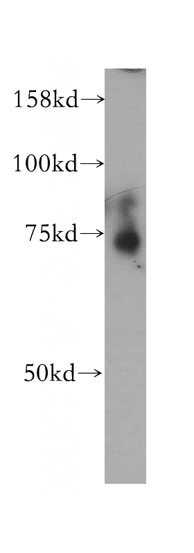 U-937 cells were subjected to SDS PAGE followed by western blot with Catalog No:111699(HSPA6 antibody) at dilution of 1:1000