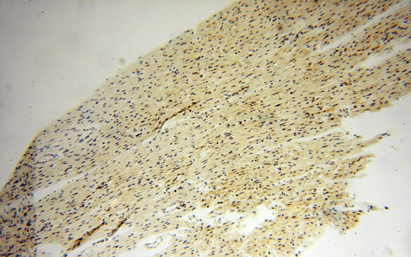 Immunohistochemical of paraffin-embedded human heart using Catalog No:110084(DNAI2 antibody) at dilution of 1:50 (under 10x lens)